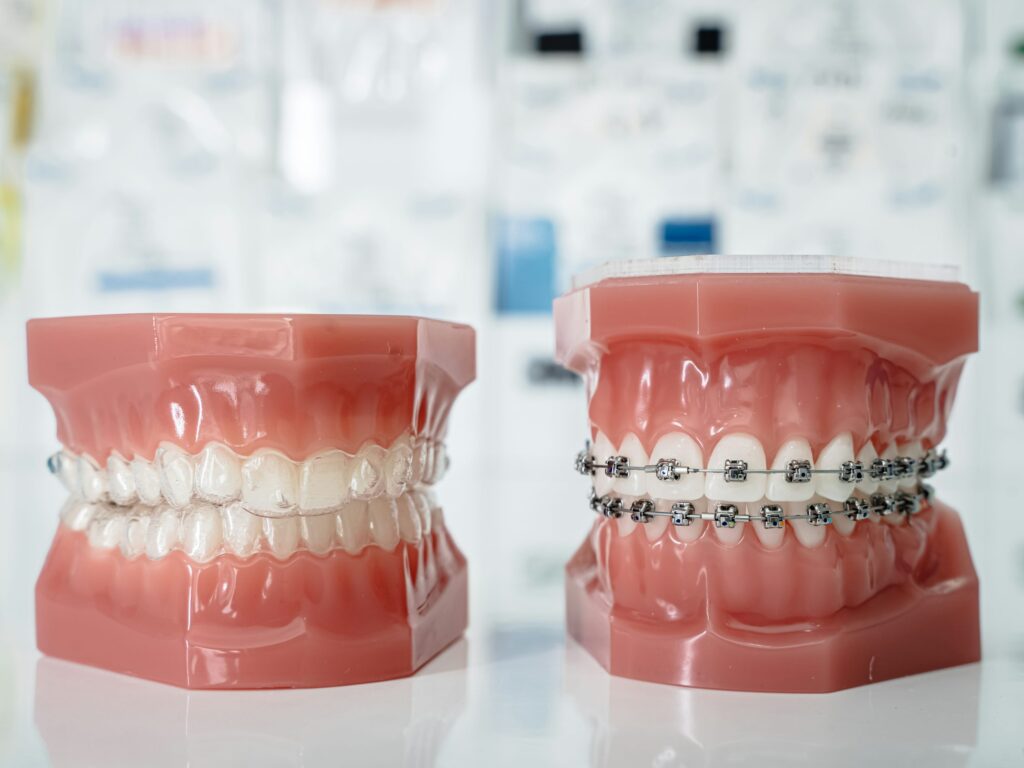 brackets odontología